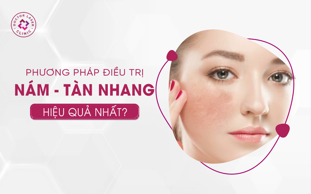 6 nguyên nhân gây nám da và mẹo điều trị chị em mà chị em nên biết