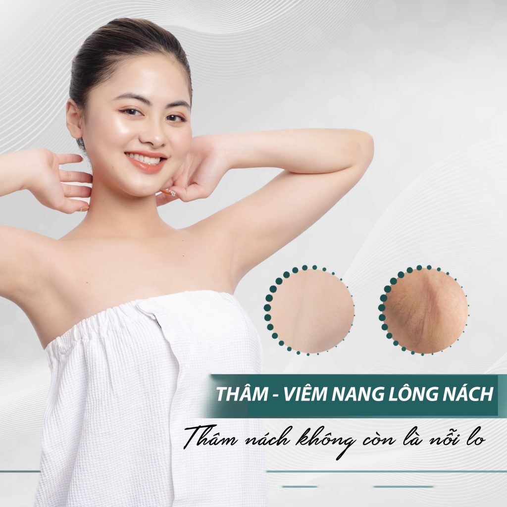 Trị Thâm Nách